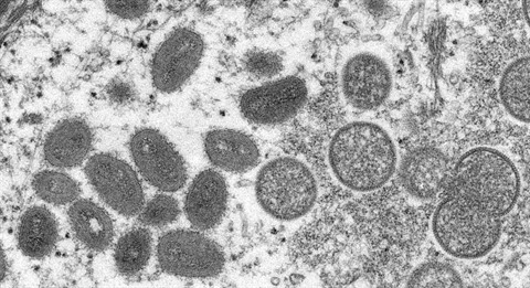 L OMS fait état de 257 cas confirmés de variole du singe